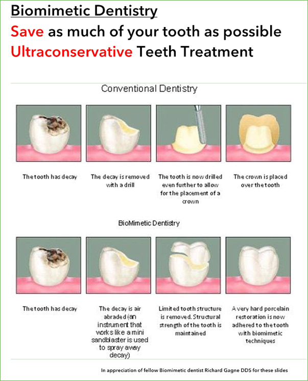 biomimetic dentistry yorba linda