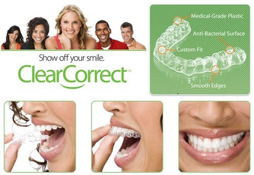 clearcorrect yorba linda