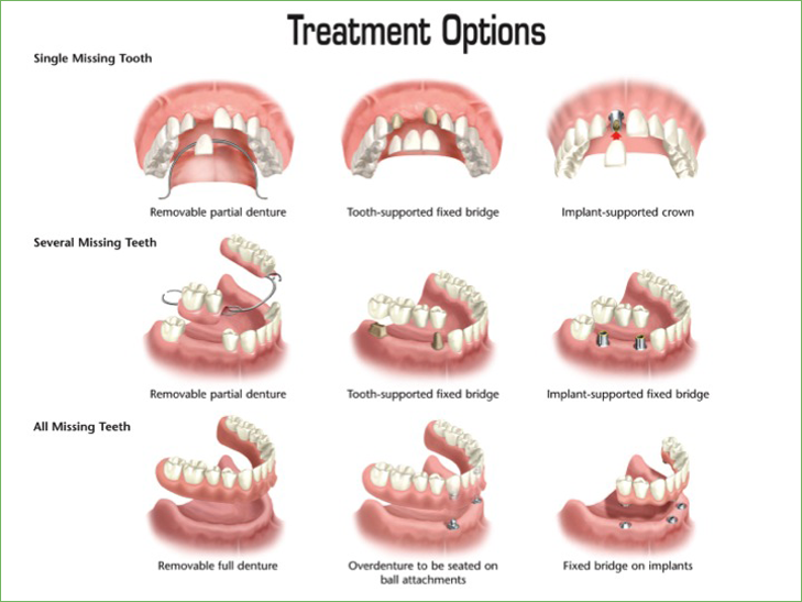 dentures yorba linda