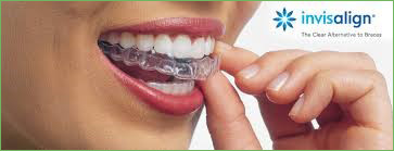 invisalign yorba linda