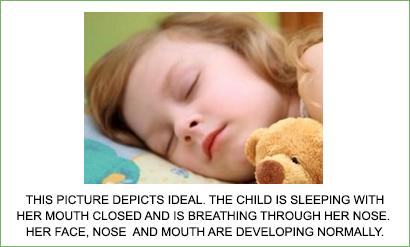 kids sleep disordered breathing yorba linda