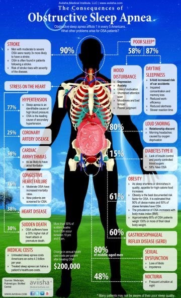 consequences of sleep apnea